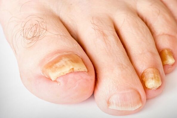 A köröm hirb harmadik szakasza