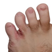 gomba az ujjak között