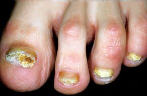 A betegség jellemzése