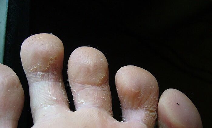 a gomba kezdeti szakasza